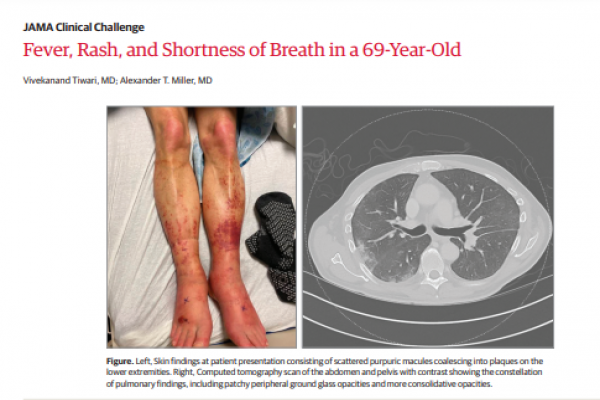 Fever, Rash, and Shortness of Breath in a 69-Year-Old