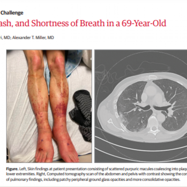 Fever, Rash, and Shortness of Breath in a 69-Year-Old