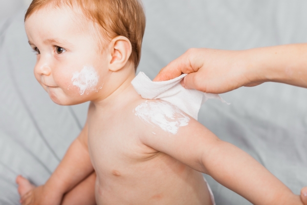 Atopic Dermatitis (AD) in Children
