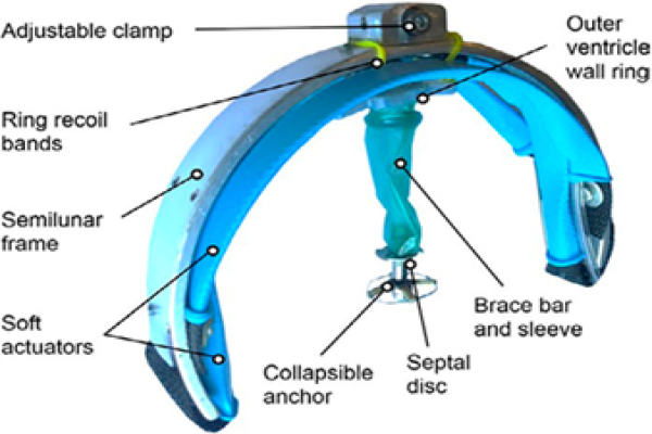 Soft robotic device for unilateral heart failure
