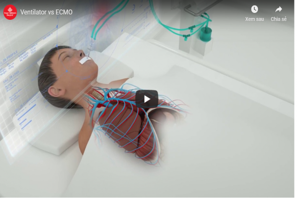 What is the difference between mechanical ventilation and ECMO?